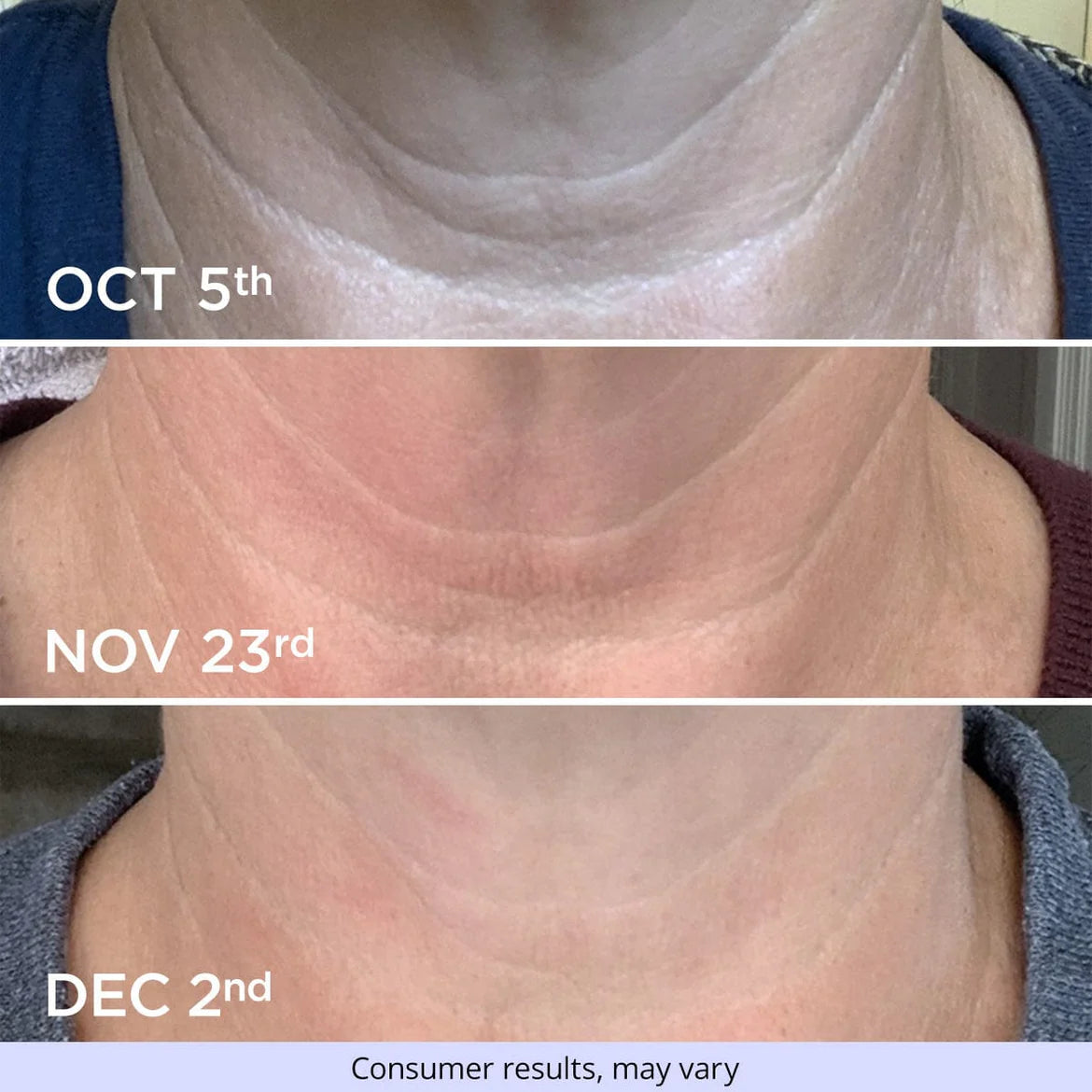 Ladies Lift & Firm Neck Cream