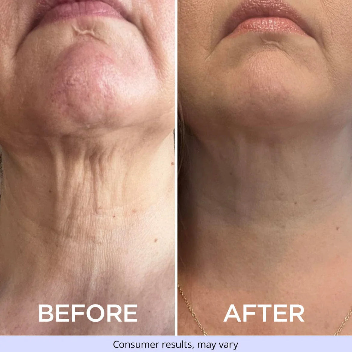 Ladies Lift & Firm Neck Cream
