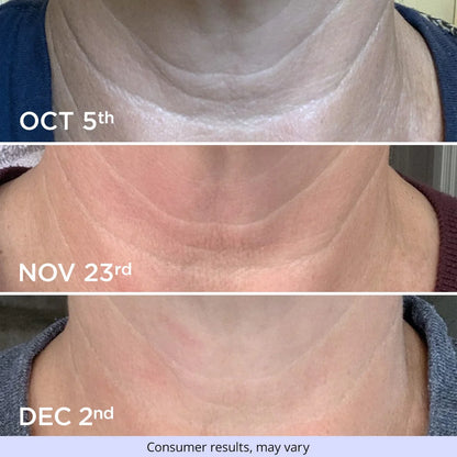 Ladies Lift & Firm Neck Cream